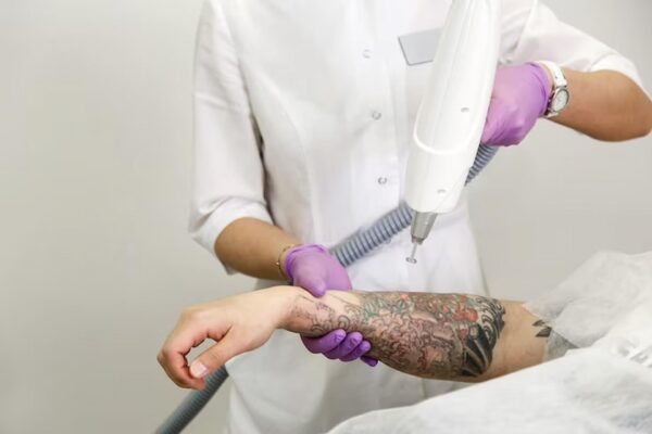Understanding The Risks of Tattoo Removal And Knowing When It Shouldn’t Be Performed